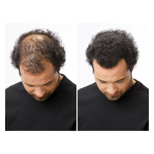 TOPPIK FIBRA CAPILAR NEGRO* ULTIMA EDICION