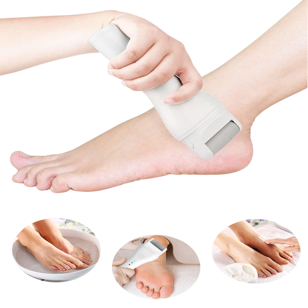 Removedor de Callos Eléctrico Recargable Exfoliante de Pies