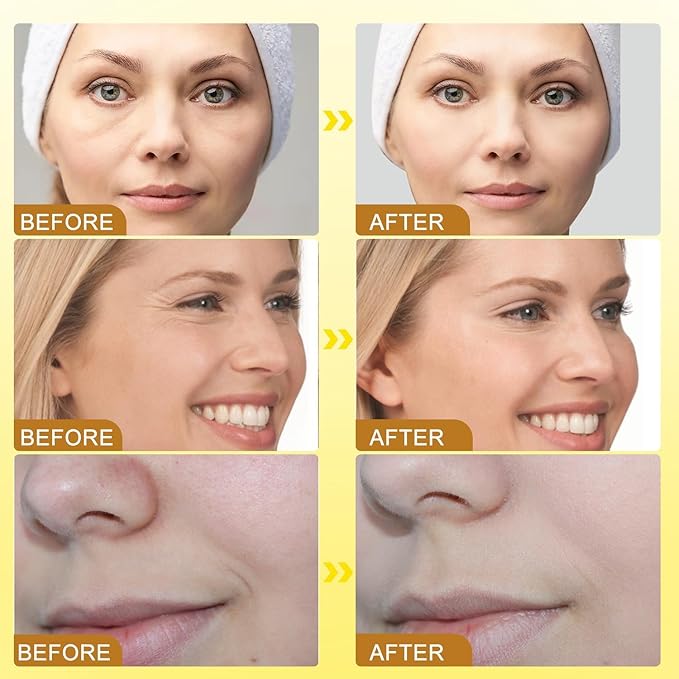 🐝✨ Botox Bee Venom – Crema Rejuvenecedora con Veneno de Abeja (20g)