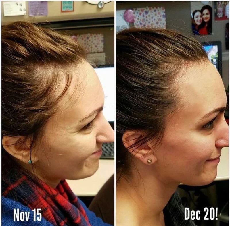 Suero para el crecimiento del cabello - Multi-Peptide Serum for Hair Density