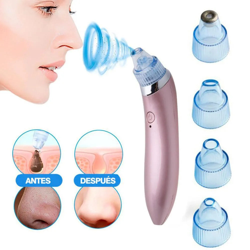 Extractor De Puntos Negros Y Espinillas + 3 mascarillas de colageno gratis